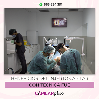 Beneficios del injerto capilar con t�cnica FUE
