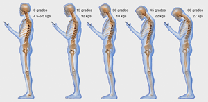 Los efectos de los tel�fonos sobre nuestro cuello