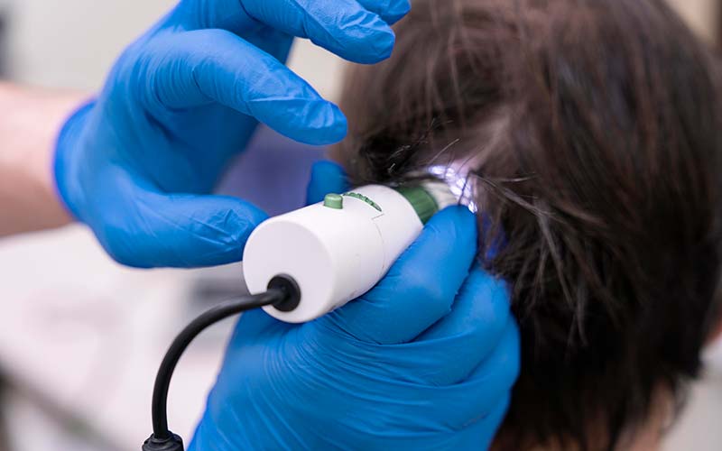 �Qu� son las unidades foliculares?